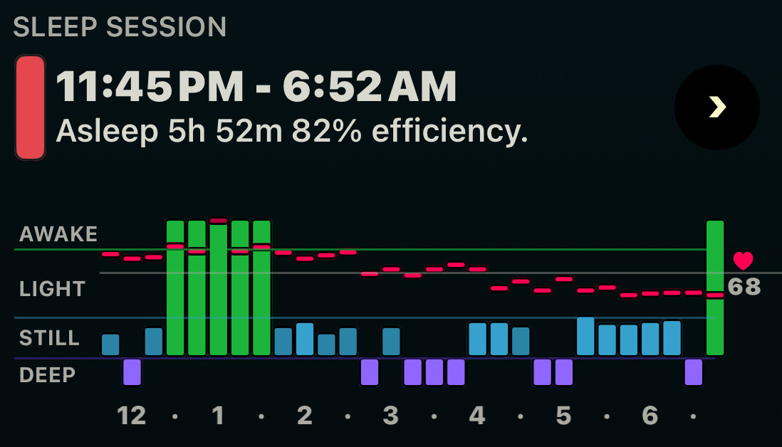 Sleep graph showing me getting woke up at 2:00am and not falling asleep until 5:00am.